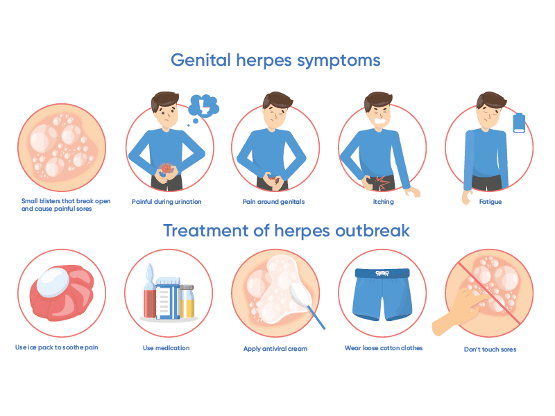 Herpes Simplex (Symptoms and Treatment)