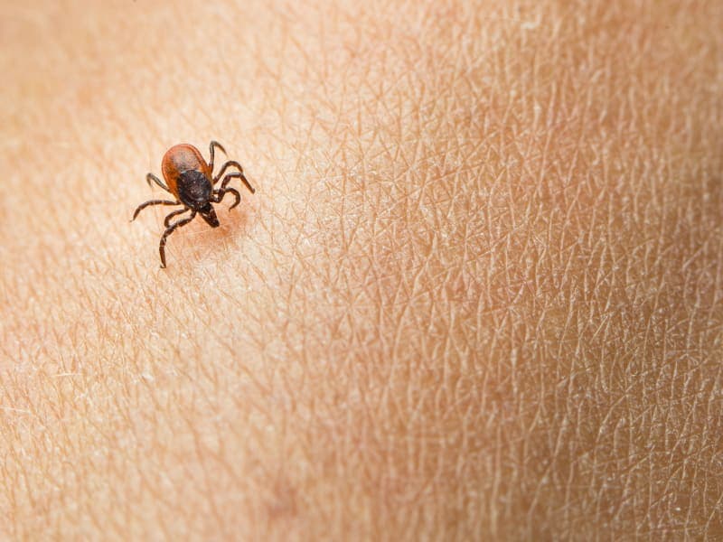 Lyme Disease Symptoms and Rash (Plus Treatment)