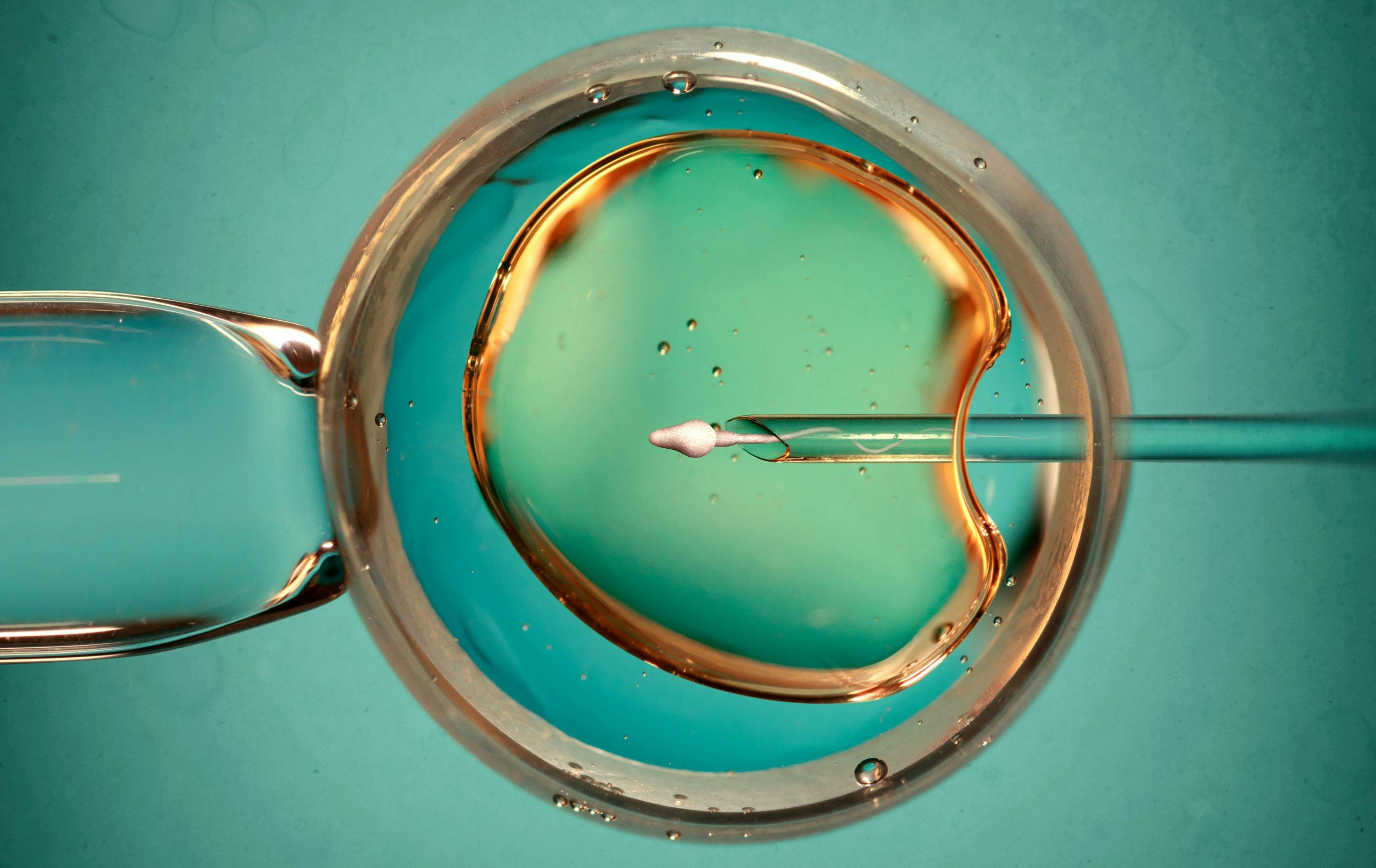 IVF method used during treatment of the infertility